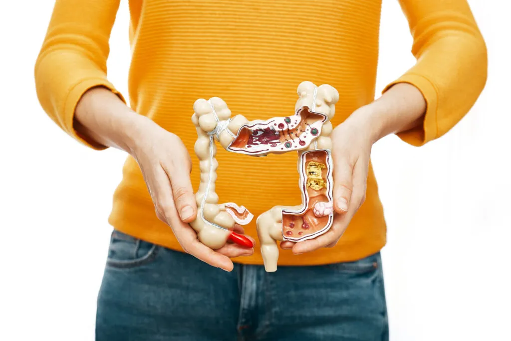 Modello anatomico dell'intestino tenuto in mano per illustrare il processo digestivo e sfatare il mito della fermentazione della frutta dopo i pasti.